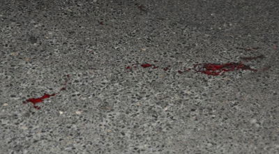 זירת האירוע, אמש