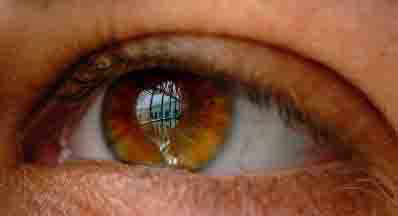 השתלת קרנית מאדם מת. מותרת? מרן הרב עובדיה יוסף משיב