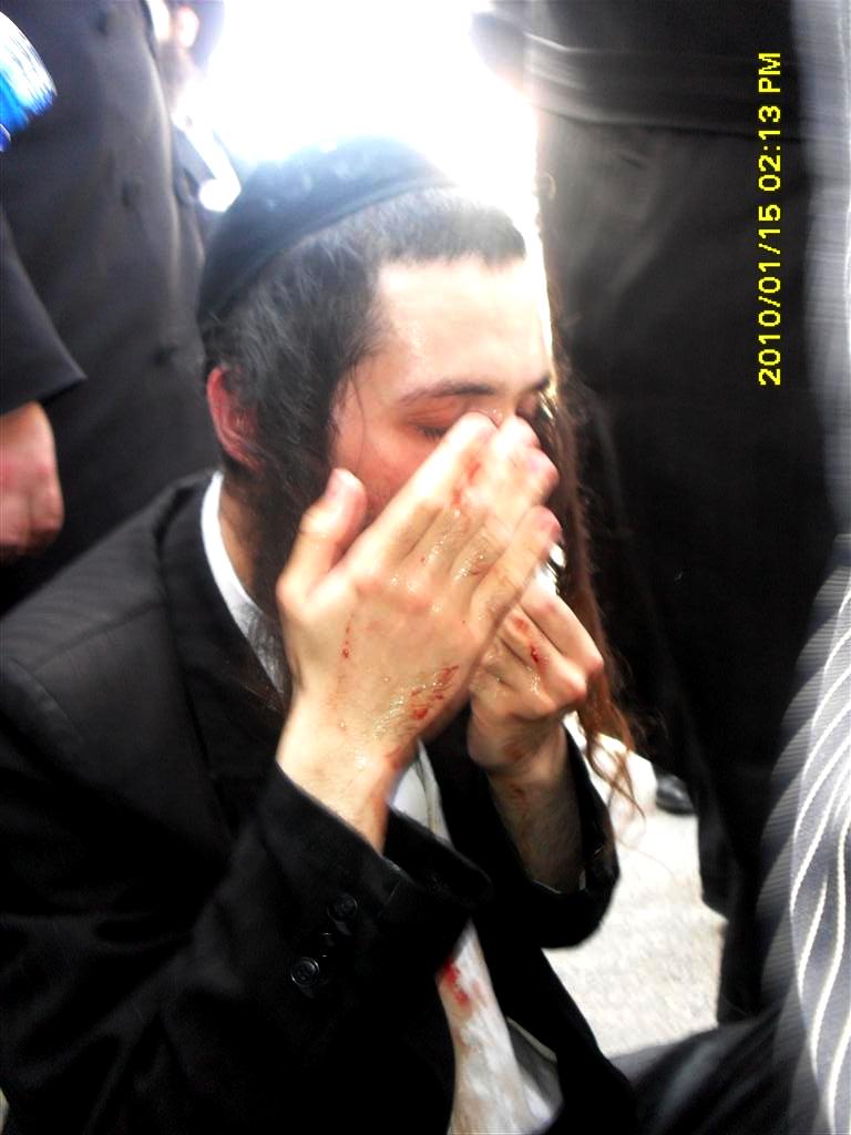 ההפגנות התחדשו ביפו, כמה מפגינים נפצעו