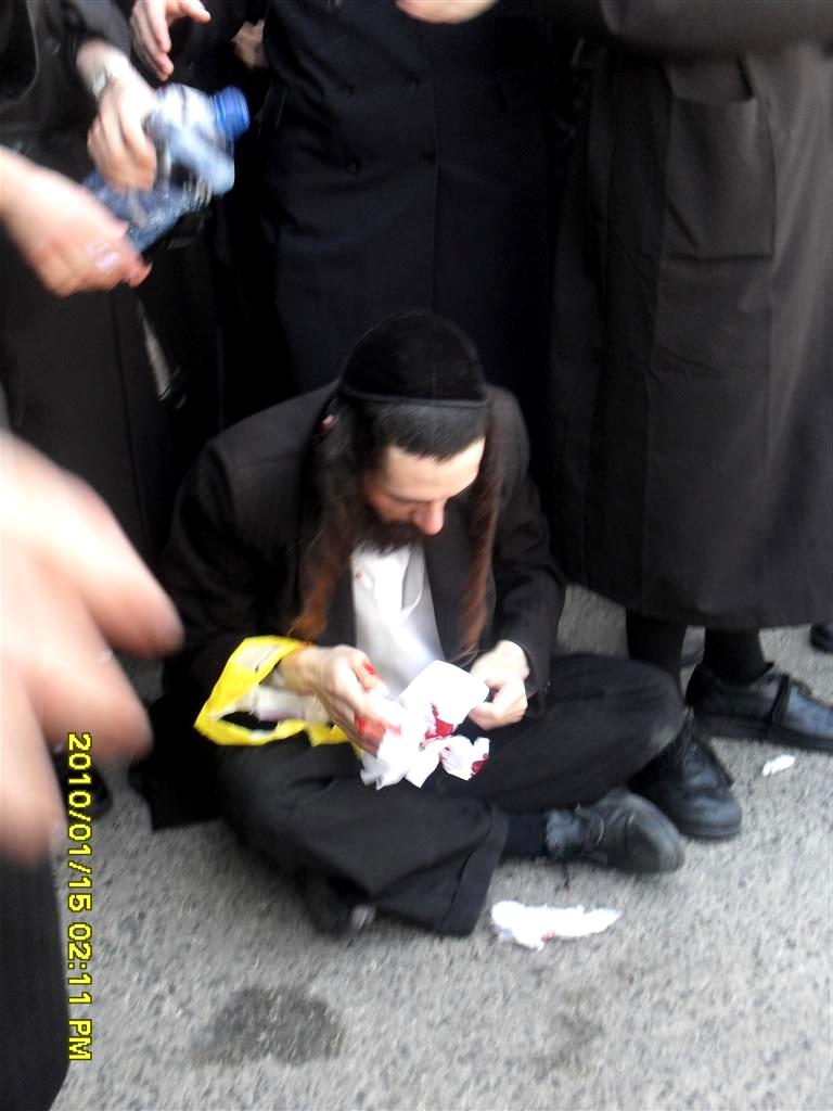 ההפגנות התחדשו ביפו, כמה מפגינים נפצעו