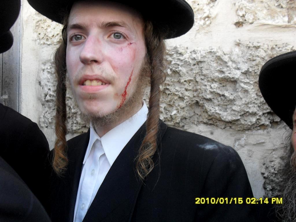 ההפגנות התחדשו ביפו, כמה מפגינים נפצעו