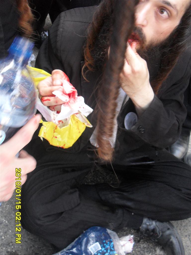 ההפגנות התחדשו ביפו, כמה מפגינים נפצעו