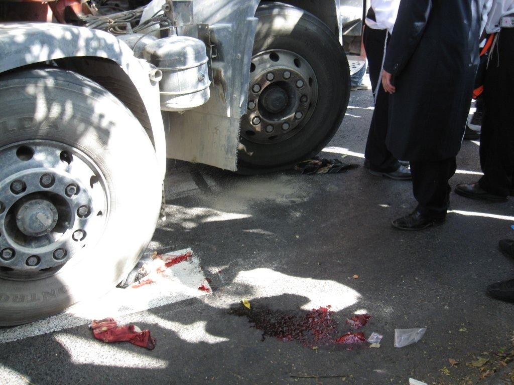 ירושלים: חרדית נפגעה ממערבל בטון - צפו בתמונות