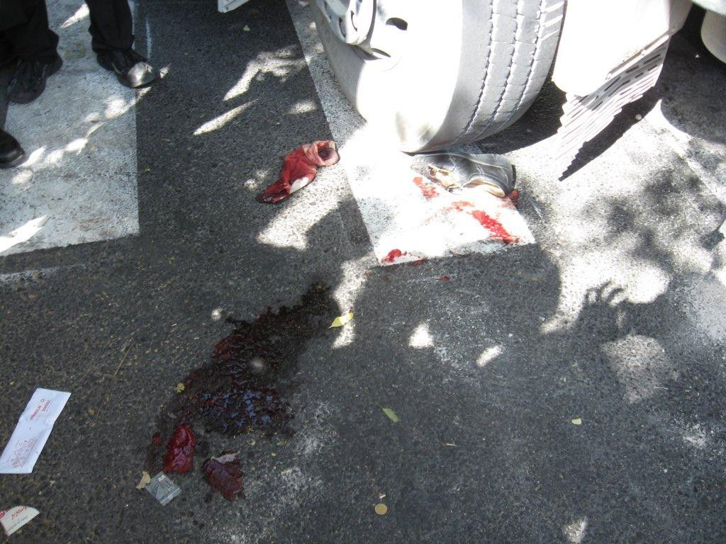 ירושלים: חרדית נפגעה ממערבל בטון - צפו בתמונות