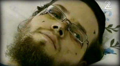 גוטשטיין בבית-החולים, היום