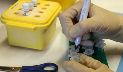 הסרטן מתפשט: עלייה בנתוני התחלואה