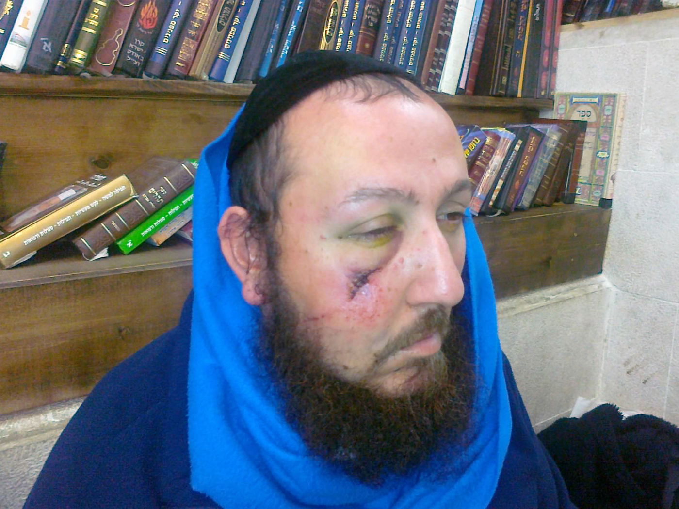 מחריד: מתפלל הותקף בקבר שמעון הצדיק