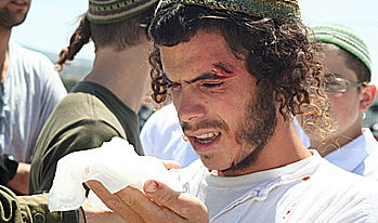 עימותים בקבר יוסף. ארכיון (פלאש 90)