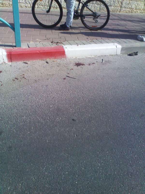 בית החולים 'שניידר': הילד מאלעד יצא מכלל סכנה