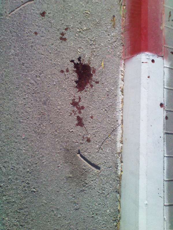 בית החולים 'שניידר': הילד מאלעד יצא מכלל סכנה