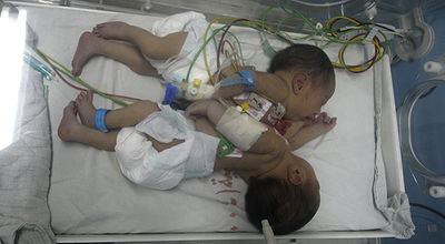 (צילום אילוסטרציה: פלאש 90)