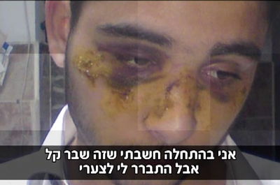זוועה באתר החרמון: עובדים ביצעו לינץ' אכזרי בנער חרדי