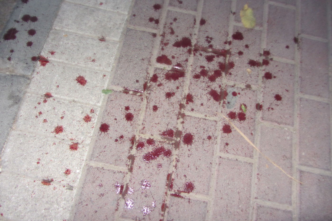 תקרית אלימה בפוניבז': בחור נפצע בינוני