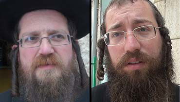 החרדי שהותקף בגרזן מדבר: "הכיפה שחבשתי הצילה חיי"