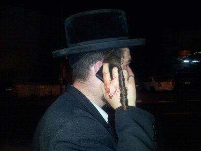 ערבי תקף אברך בירושלים: "פחדתי שיהרוג את ילדיי"