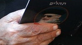 ידו של הרב לאחר החתך