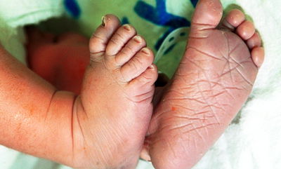 אילוסטרציה