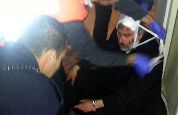 נתי גרוסמן לאחר תקיפתו