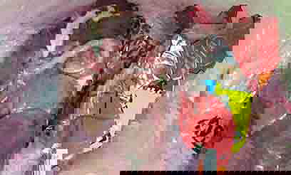 התולעת הענקית שהתגלתה בכבד של תנובה