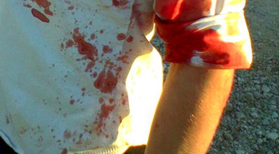 אחד הפצועים בפיגוע הירי