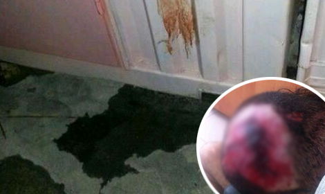 אנטישמיות באומן. בעיגול: האברך הפצוע