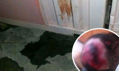 אנטישמיות באומן. בעיגול: האברך הפצוע