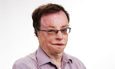 הבחירות בירושלים • קלמנוביץ' ל'סרוגים': לא תומך באף מועמד לראשות