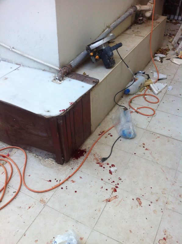 בית שמש: בן 40 נפל מסולם ונחבל קשות בראשו