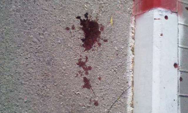 בדרך לתפילה: בן 83 נהרג בתאונת פגע וברח בראשון לציון