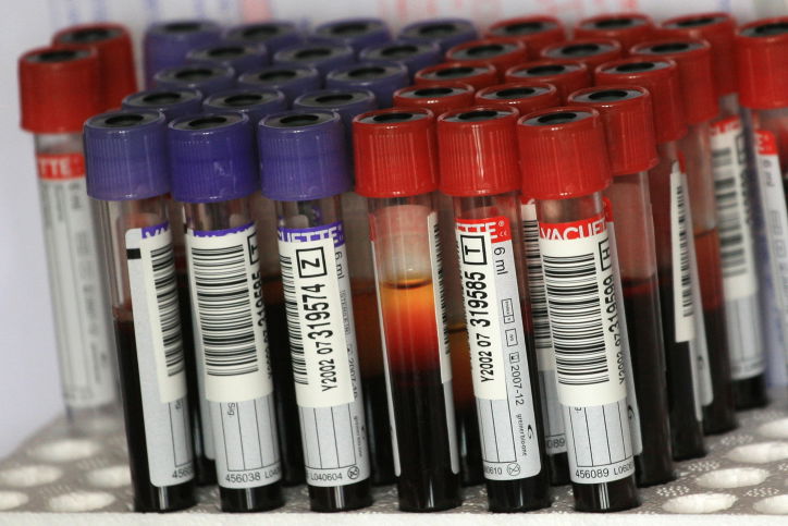 לאחר השפלת הח"כית: נהלי התרמת הדם יבחנו מחדש