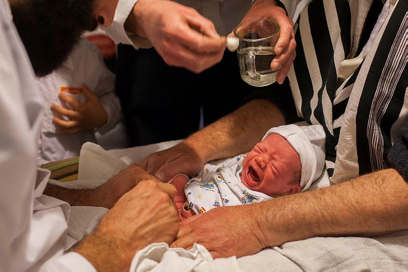 ברית מילה, אילוסטרציה