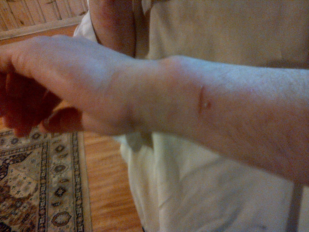 מחריף המאבק בכת 'לב טהור': שביתת רעב וטלאי צהוב