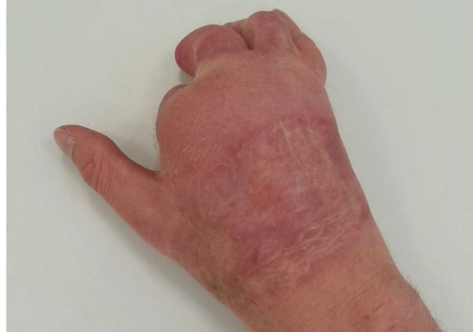 התמונה המחרידה שהעלה פייגלין