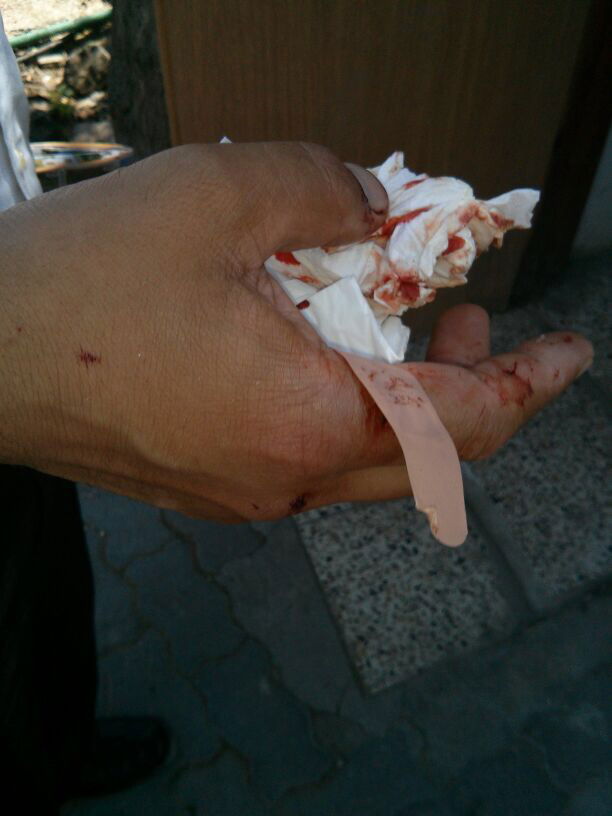 צפו: משפחה חרדית נרגמה באבנים ובקבוקים בדרך לכותל