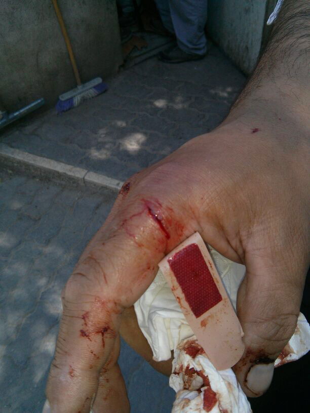 צפו: משפחה חרדית נרגמה באבנים ובקבוקים בדרך לכותל