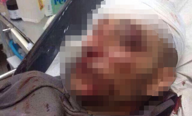 שני ערבים הותקפו בנווה יעקב; מהומות בירושלים