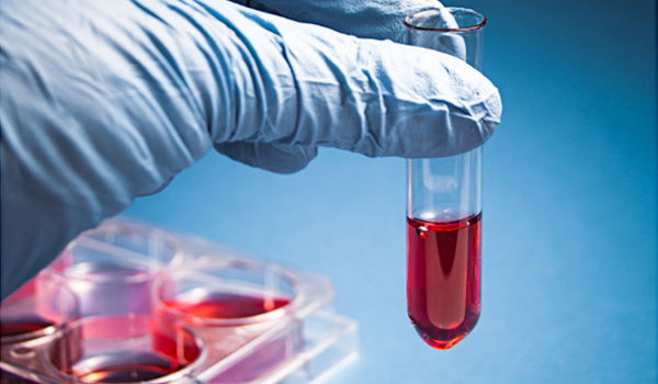 אילוסטרציה