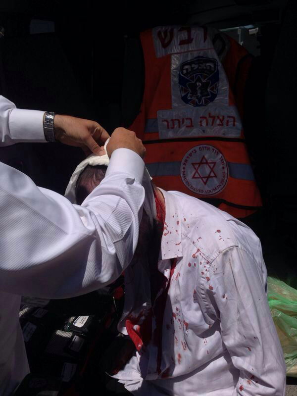 טרור בחוסאן: קבלן חרדי מביתר עילית נפצע ונשדד