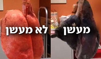 סרטון מזעזע: זה מה שעישון סיגריות עושה לריאות שלכם