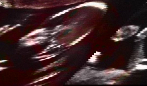 להיט ברשת האינטרנט: עובר במעי אמו עושה "לייק"