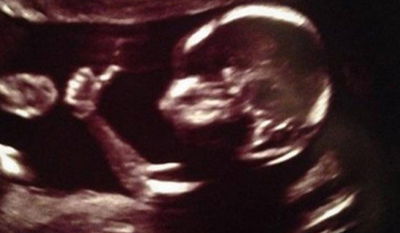 להיט ברשת האינטרנט: עובר במעי אמו עושה "לייק"