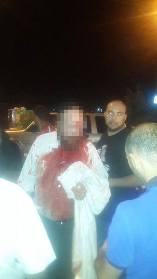 בית חנינה: חרדי נפצע קל מיידוי אבנים