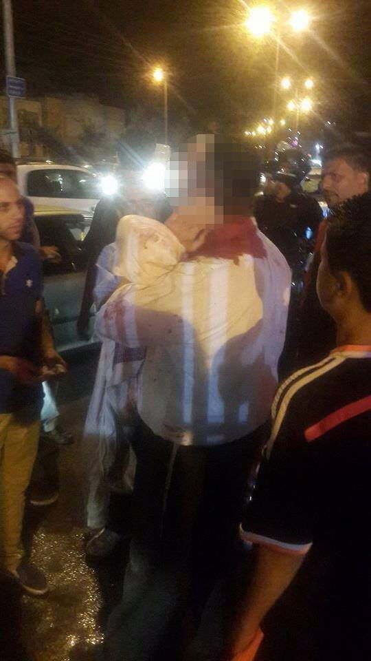 בית חנינה: חרדי נפצע קל מיידוי אבנים