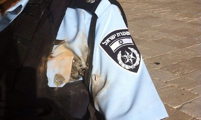 שוטר שנפצע במהומות היום