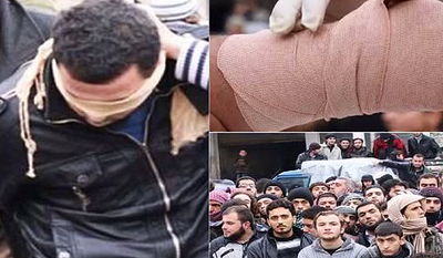 חדש מדאעש: מעמד כריתת יד לגנב