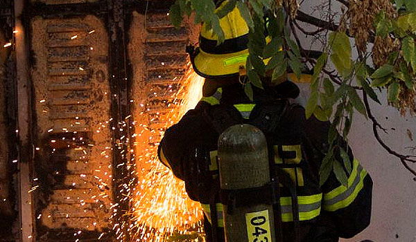 ירושלים: בת 30 נפצעה קשה בשריפה