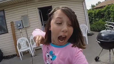 אאוצ': הילדה שעקרה שן עם "חץ וקשת"