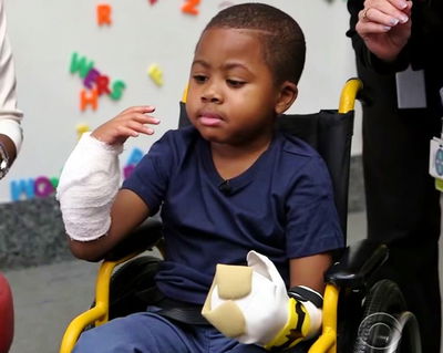 הארווי בן ה-8 לפני ההשתלה