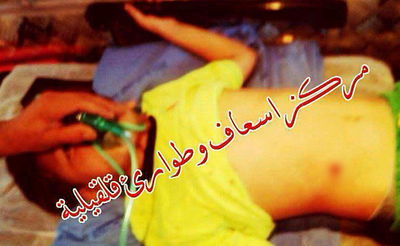 הילד מפונה לבית החולים