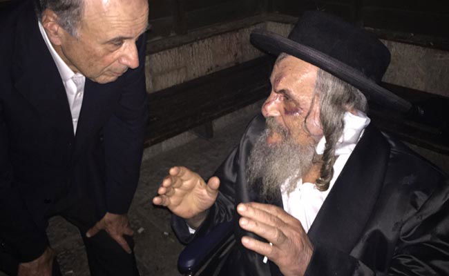 ראש העיר בא לחזק את פצועי הפיגועים והתרגש: "אין לפצועים טענות על ה'"